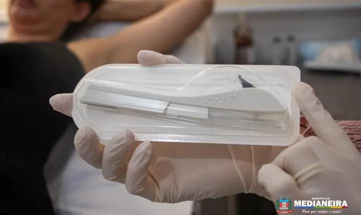 MUNICÍPIO DE MEDIANEIRA INICIA OFERTA DO IMPLANTE CONTRACEPTIVO IMPLANON PELO SUS